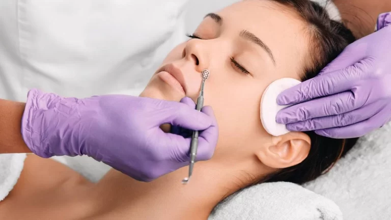 facial with extractions in Fort Worth, TX