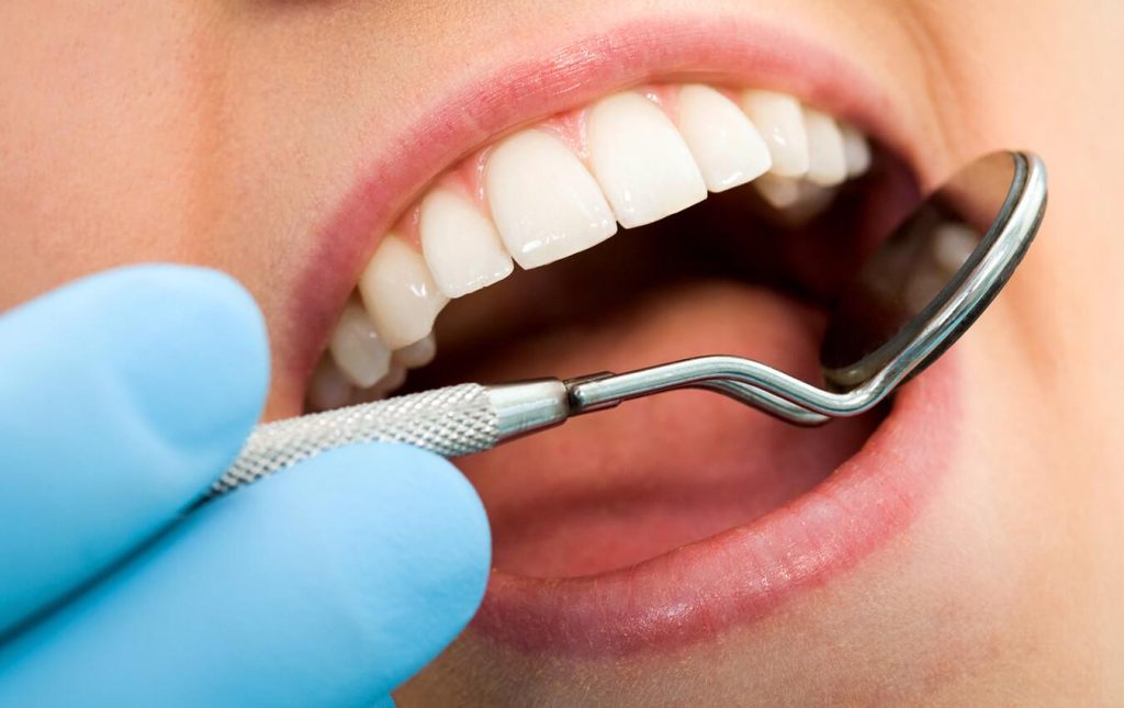 Dental Care Tips
