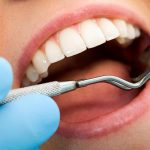Dental Care Tips